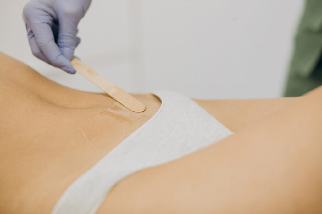 laser epilation, hair removal therapy